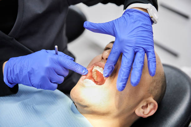 Best Emergency Treatment for Dental Infections or Abscesses in Lisbon, OH